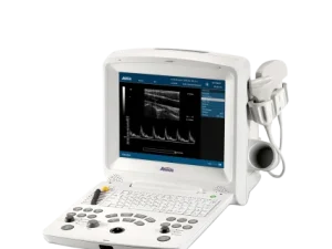 AV-60 Digital Ultrasonic Diagnostic Imaging System