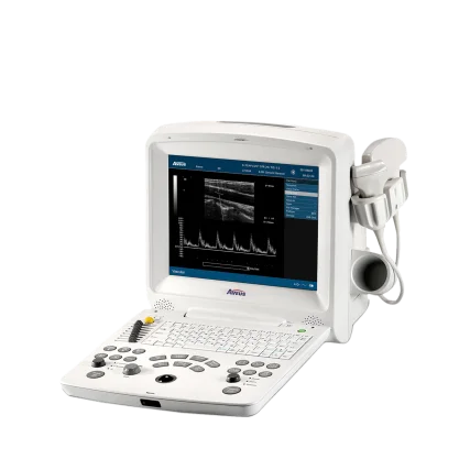 AV-60 Digital Ultrasonic Diagnostic Imaging System