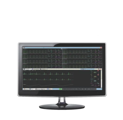 AV AV – Central Monitoring System